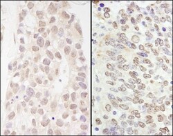 p66 beta Antibody, Novus Biologicals 0.1mL; Unlabeled:Antibodies, Polyclonal
